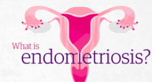 Endo Impacts People with Uteruses, Not Just Women